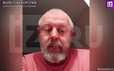 Хирург рассказал о состоянии мальчика из Сочи с разорванным хаски лицом — Новости