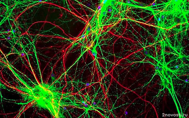 ScienceAlert: Деградация мозговых тканей начинается в 44 года — Новости